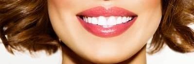 teeth bleaching in Lake Charles Louisiana