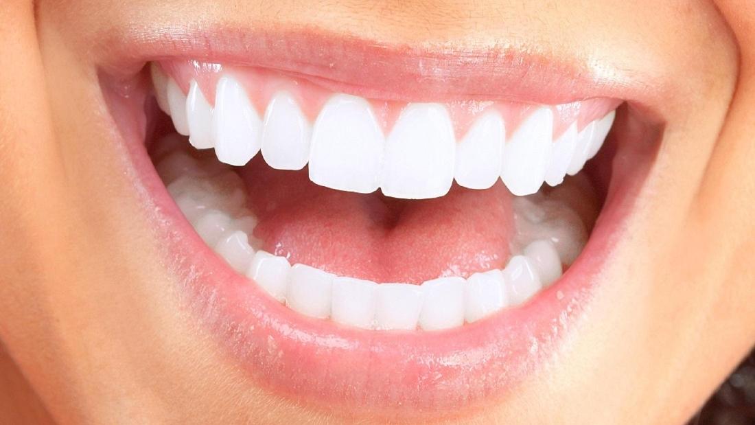 Same Day Dental Crowns Lake Charles LA CEREC Dental Restorations