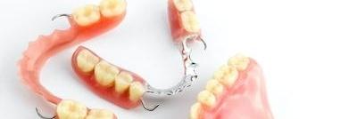 partial dentures lake charles