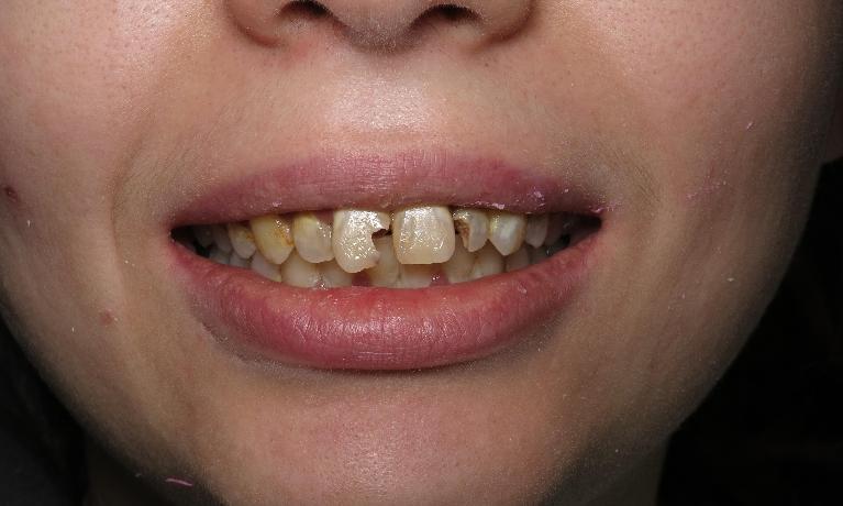 Teeth Repair Smile Gallery